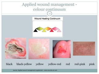 Applied wound management -
colour continuum
black black-yellow yellow yellow-red red red-pink pink
21
source: Applied wound management supplement – www.wounds-uk.com
 