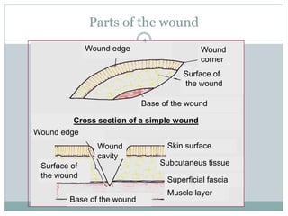 Parts of the wound
Wound edge Wound
corner
Surface of
the wound
Base of the wound
Cross section of a simple wound
Skin surface
Subcutaneus tissue
Superficial fascia
Muscle layer
Base of the wound
Wound edge
Surface of
the wound
Wound
cavity
4
 