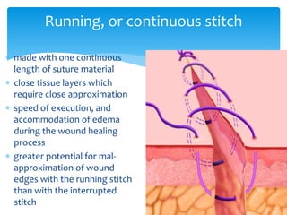 Running, or continuous stitch
 made with one continuous
length of suture material
 close tissue layers which
require close approximation
 speed of execution, and
accommodation of edema
during the wound healing
process
 greater potential for mal-
approximation of wound
edges with the running stitch
than with the interrupted
stitch
 