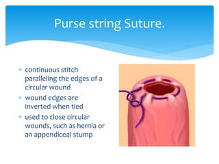 Purse string Suture.
 continuous stitch
paralleling the edges of a
circular wound
 wound edges are
inverted when tied
 used to close circular
wounds, such as hernia or
an appendiceal stump
 