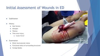 Initial Assessment of Wounds in ED
 Stabilisation
 History
 Host factors
 Allergies
 Tetanus
 Time since injury
 ‘Golden Period’
 Examination
 Distal neurovascular status
 Functional status of surrounding structures
 Foreign Bodies
 