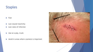 Staples
 Fast
 Low wound reactivity
 Low rates of infection
 Use on scalp, trunk
 Avoid in areas where cosmesis is important
 