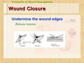 Wound management | PPT