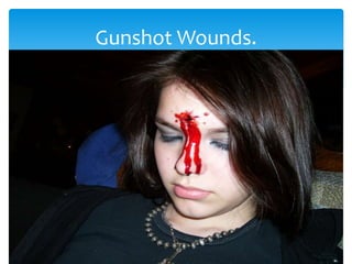 Gunshot Wounds.
 