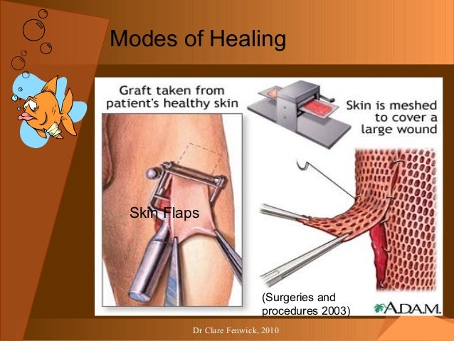 Wound care manual keryln carville