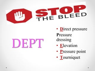 DEPT
• Direct pressure
Pressure
dressing
• Elevation
• Pressure point
• Tourniquet
 