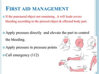 FIRST AID MANAGEMENT
 If the punctured object not remaining , it will leads severe
bleeding according to the pierced object & affected body part.
 Apply pressure directly and elevate the part to control
the bleeding.
 Apply pressure in pressure points
 Call emergency (112)
 