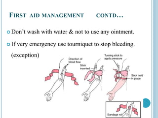 FIRST AID MANAGEMENT CONTD…
 Don’t wash with water & not to use any ointment.
 If very emergency use tourniquet to stop bleeding.
(exception)
 
