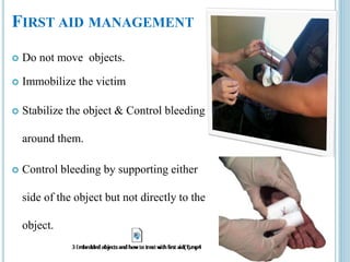 FIRST AID MANAGEMENT
 Do not move objects.
 Immobilize the victim
 Stabilize the object & Control bleeding
around them.
 Control bleeding by supporting either
side of the object but not directly to the
object.
 