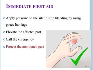 IMMEDIATE FIRST AID
 Apply pressure on the site to stop bleeding by using
gauze bandage
 Elevate the affected part
 Call the emergency
 Protect the amputated part
 