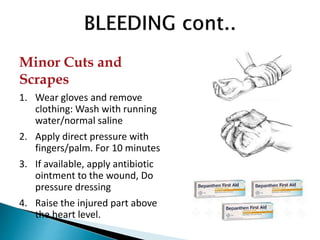Minor Cuts and
Scrapes
1. Wear gloves and remove
clothing: Wash with running
water/normal saline
2. Apply direct pressure with
fingers/palm. For 10 minutes
3. If available, apply antibiotic
ointment to the wound, Do
pressure dressing
4. Raise the injured part above
the heart level.
 