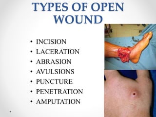 TYPES OF OPEN
WOUND
• INCISION
• LACERATION
• ABRASION
• AVULSIONS
• PUNCTURE
• PENETRATION
• AMPUTATION
 