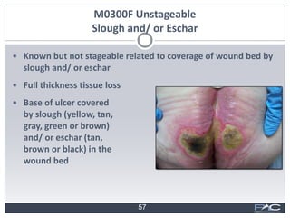 WoundRounds: Clinical Reimbursement and Wound Care webinar slides | PDF