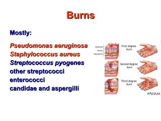 Burns M ostly: Pseudomonas aeruginosa Staphylococcus aureus Streptococcus pyogenes other streptococci enterococci candidae and aspergilli 