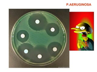 P.AERUGINOSA 