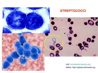 Below: http://upload.wikimedia.org Left:  microbewiki . kenyon . edu .   STREPTOCOCCI 
