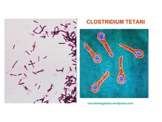 microbiologybytes . wordpress . com /   CLOSTRIDIUM TETANI 