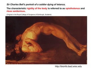 Sir Charles Bell's portrait of a soldier dying of tetanus.  The characteristic  rigidity of the body  is referred to as  opisthotonus  and  risus sardonicus .  (Original in the Royal College of Surgeons of Edinburgh, Scotland)  http://bioinfo.bact.wisc.edu 