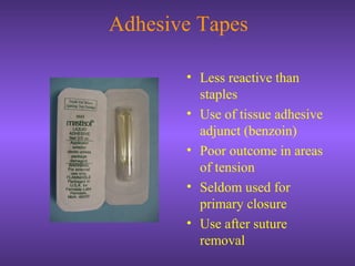 Adhesive Tapes
• Less reactive than
staples
• Use of tissue adhesive
adjunct (benzoin)
• Poor outcome in areas
of tension
• Seldom used for
primary closure
• Use after suture
removal
 