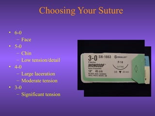 Choosing Your Suture
• 6-0
– Face
• 5-0
– Chin
– Low tension/detail
• 4-0
– Large laceration
– Moderate tension
• 3-0
– Significant tension
 