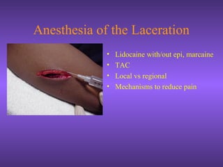 Anesthesia of the Laceration
• Lidocaine with/out epi, marcaine
• TAC
• Local vs regional
• Mechanisms to reduce pain
 