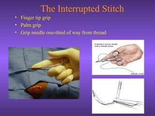 The Interrupted Stitch
• Finger tip grip
• Palm grip
• Grip needle one-third of way from thread
 
