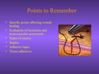 Points to Remember
• Specific points affecting wound
healing
• Evaluation of laceration and
neurovascular assessment
• Types of sutures
• Staples
• Adhesive tapes
• Tissue adhesives
 
