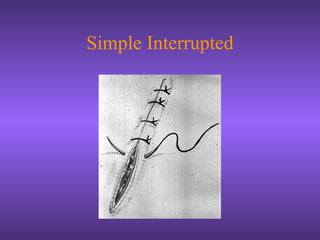 Simple Interrupted
 