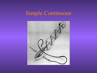 Simple Continuous
 