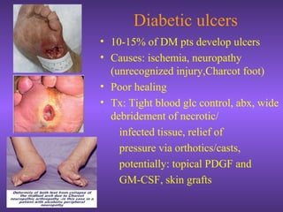 Diabetic ulcers
• 10-15% of DM pts develop ulcers
• Causes: ischemia, neuropathy
(unrecognized injury,Charcot foot)
• Poor healing
• Tx: Tight blood glc control, abx, wide
debridement of necrotic/
infected tissue, relief of
pressure via orthotics/casts,
potentially: topical PDGF and
GM-CSF, skin grafts
 