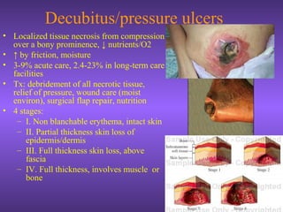 Decubitus/pressure ulcers
• Localized tissue necrosis from compression
over a bony prominence, ↓ nutrients/O2
• ↑ by friction, moisture
• 3-9% acute care, 2.4-23% in long-term care
facilities
• Tx: debridement of all necrotic tissue,
relief of pressure, wound care (moist
environ), surgical flap repair, nutrition
• 4 stages:
– I. Non blanchable erythema, intact skin
– II. Partial thickness skin loss of
epidermis/dermis
– III. Full thickness skin loss, above
fascia
– IV. Full thickness, involves muscle or
bone
 