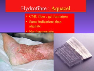 Hydrofibre : AquacelHydrofibre : Aquacel
• CMC fiber : gel formation
• Same indications than
alginate
• Non haemostatic
 
