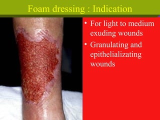 • For light to medium
exuding wounds
• Granulating and
epithelializating
wounds
Foam dressing : Indication
 