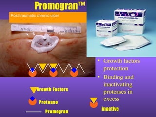 Promogran™
• Growth factors
protection
• Binding and
inactivating
proteases in
excess
Promogran
Protease
Growth Factors
inactive
Post traumatic chronic ulcer
 