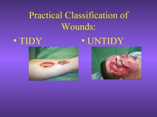 Practical Classification of
Wounds:
• TIDY • UNTIDY
 