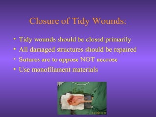Closure of Tidy Wounds:
• Tidy wounds should be closed primarily
• All damaged structures should be repaired
• Sutures are to oppose NOT necrose
• Use monofilament materials
 