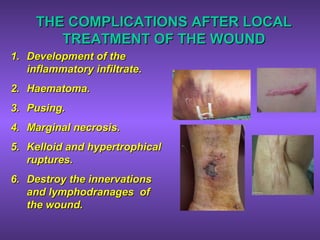 THE COMPLICATIONS AFTER LOCALTHE COMPLICATIONS AFTER LOCAL
TREATMENT OF THE WOUNDTREATMENT OF THE WOUND
1.1. Development of theDevelopment of the
inflammatory infiltrate.inflammatory infiltrate.
2.2. Haematoma.Haematoma.
3.3. Pusing.Pusing.
4.4. Marginal necrosis.Marginal necrosis.
5.5. Kelloid and hypertrophicalKelloid and hypertrophical
ruptures.ruptures.
6.6. Destroy the innervationsDestroy the innervations
and lymphodranages ofand lymphodranages of
the wound.the wound.
 