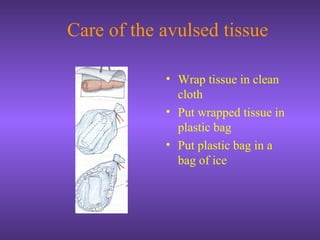 Care of the avulsed tissue
• Wrap tissue in clean
cloth
• Put wrapped tissue in
plastic bag
• Put plastic bag in a
bag of ice
 
