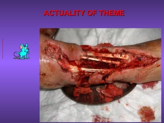 ACTUALITY OF THEMEACTUALITY OF THEME
 