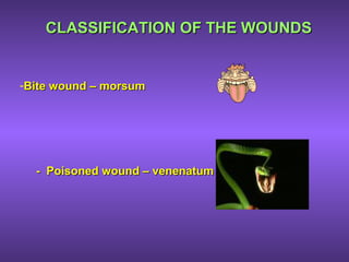 -Bite wound – morsumBite wound – morsum
- Poisoned wound – venenatum- Poisoned wound – venenatum
CLASSIFICATION OF THE WOUNDSCLASSIFICATION OF THE WOUNDS
 