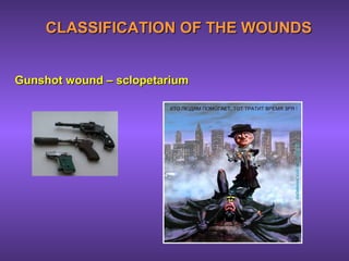 CLASSIFICATION OF THE WOUNDSCLASSIFICATION OF THE WOUNDS
Gunshot wound – sclopetariumGunshot wound – sclopetarium
 