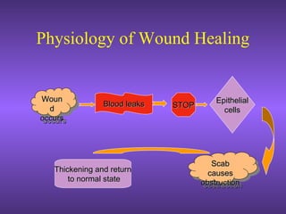 Physiology of Wound Healing
Blood leaksBlood leaksWounWoun
dd
occursoccurs
WounWoun
dd
occursoccurs
STOPSTOP
EpithelialEpithelial
cellscells
ScabScab
causescauses
obstructionobstruction
ScabScab
causescauses
obstructionobstruction
Thickening and returnThickening and return
to normal stateto normal state
 