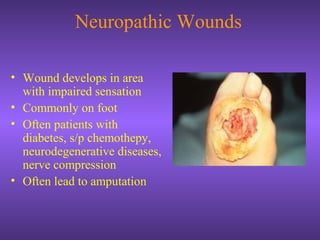 Neuropathic Wounds
• Wound develops in area
with impaired sensation
• Commonly on foot
• Often patients with
diabetes, s/p chemothepy,
neurodegenerative diseases,
nerve compression
• Often lead to amputation
 