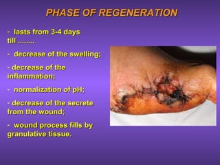 PHASE OF REGENERATIONPHASE OF REGENERATION
- lasts from 3-4 dayslasts from 3-4 days
tilltill ................
- decrease of the swelling;decrease of the swelling;
- decrease of thedecrease of the
inflammation;inflammation;
- normalization of рН;normalization of рН;
- decrease of the secretedecrease of the secrete
from the wound;from the wound;
- wound process fills bywound process fills by
granulative tissue.granulative tissue.
 