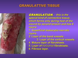 GRANULATTIVE TISSUEGRANULATTIVE TISSUE
GRANULATIONGRANULATION - this is the- this is the
special kind of connective tissue,special kind of connective tissue,
which forms only during heal of thewhich forms only during heal of the
wound by second tension and has 6wound by second tension and has 6
layers:layers:
1.1. Superficial leukocytic-necroticSuperficial leukocytic-necrotic
layers.layers.
2. Layer of the band vessels.2. Layer of the band vessels.
3. Layer of the vertical vessels.3. Layer of the vertical vessels.
4. Mature layer of fibroblasts.4. Mature layer of fibroblasts.
5. Layer of5. Layer of horizontalhorizontal fibroblasts.fibroblasts.
6. Fibrous layer.6. Fibrous layer.
 