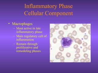 Inflammatory Phase
Cellular Component
• Macrophages
– Most active in late
inflammatory phase
– Main regulatory cell of
inflammation
– Remain through
proliferative and
remodeling phases
 
