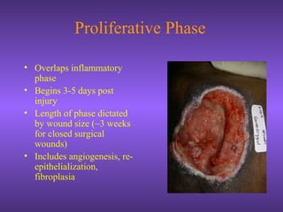 Proliferative Phase
• Overlaps inflammatory
phase
• Begins 3-5 days post
injury
• Length of phase dictated
by wound size (~3 weeks
for closed surgical
wounds)
• Includes angiogenesis, re-
epithelialization,
fibroplasia
 