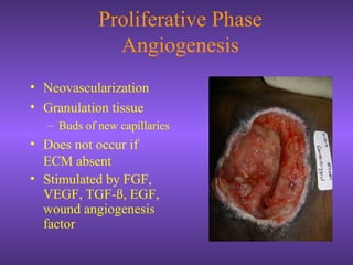Proliferative Phase
Angiogenesis
• Neovascularization
• Granulation tissue
– Buds of new capillaries
• Does not occur if
ECM absent
• Stimulated by FGF,
VEGF, TGF-ß, EGF,
wound angiogenesis
factor
 