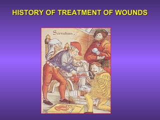 HISTORY OF TREATMENT OF WOUNDSHISTORY OF TREATMENT OF WOUNDS
 
