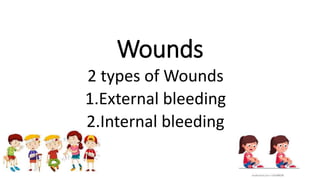 Wounds
2 types of Wounds
1.External bleeding
2.Internal bleeding
 